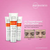 Tranacix Cream 30g in UAE –3% Tranacix Acid Cream  – Aurasence